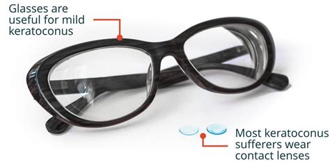 Glasses For Keratoconus