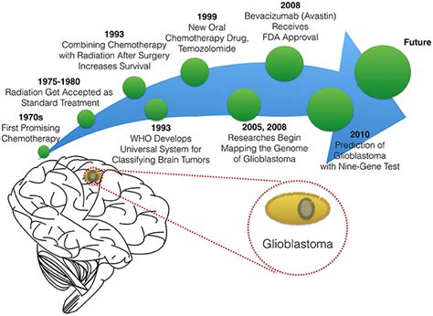 glioblastoma multiforme new treatment