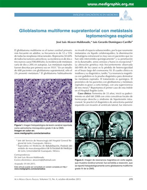 glioblastoma multiforme pdf