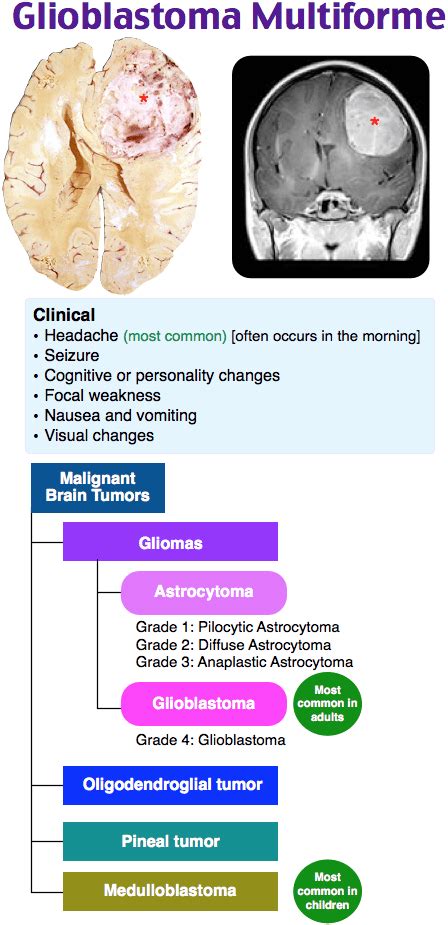 glioblastoma symptoms early
