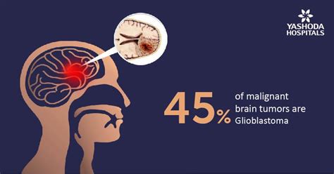 glioma brain tumor treatment side effects