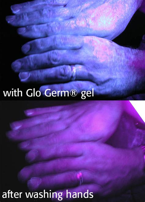 glow germ gel