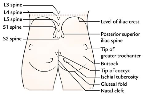 gluteal fold vs cleft