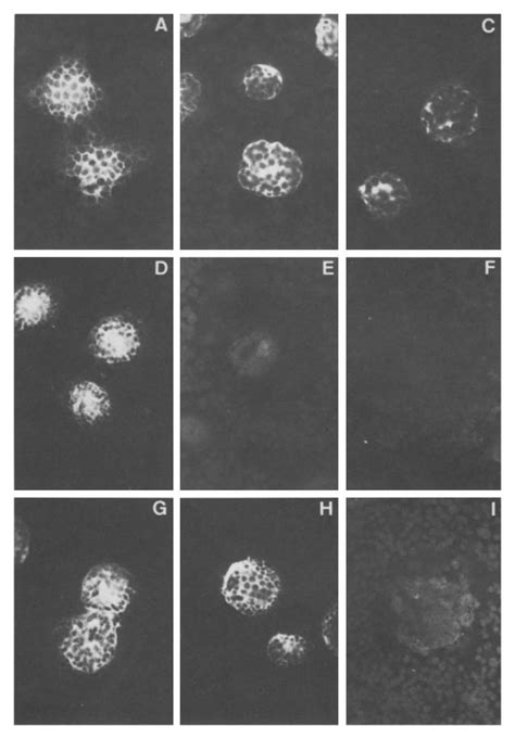 Glycoprotein Antigenic Variation