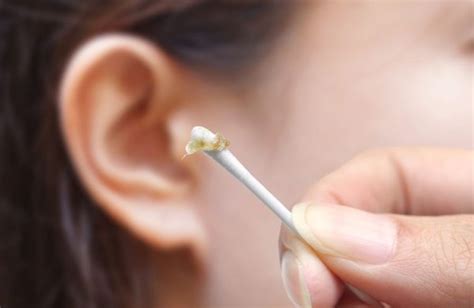 50 years worth of Ear Wax Removed YouTube
