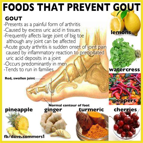 Gout diet list of foods to avoid Health Blog