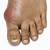 gout symptoms middle toe