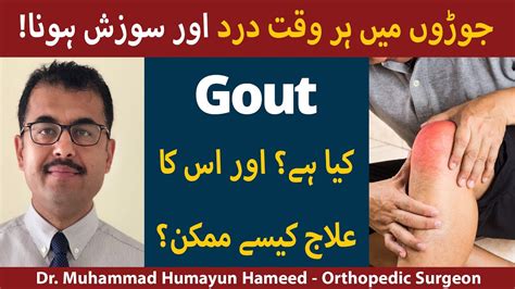 gout mean in urdu