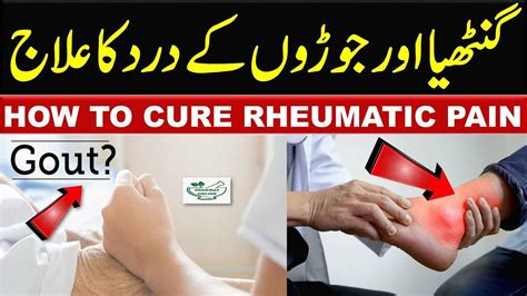 gout pain explain in urdu