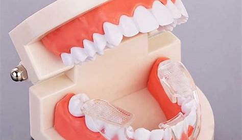 Innova Pharm Pour une orthodontie fonctionnelle