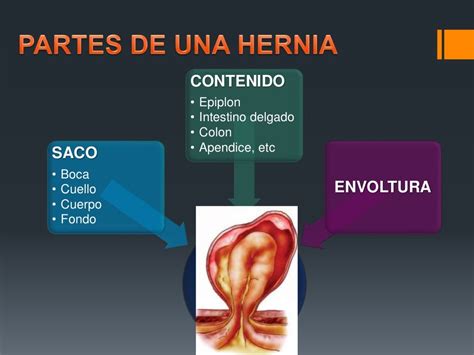 gpc hernia inguinal adulto