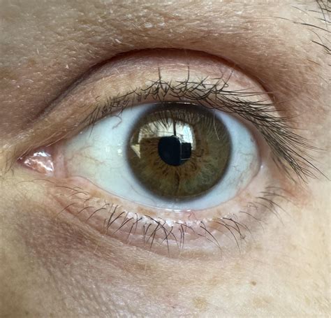 Green Ring In Vision