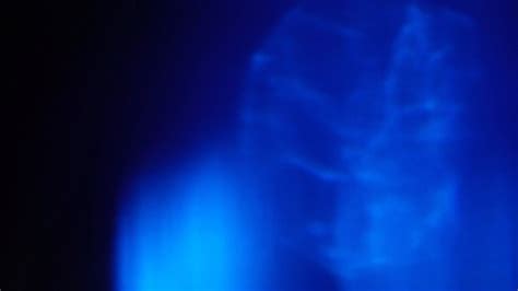 gross pics shine leaks