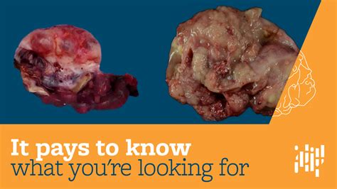 grossly normal meaning