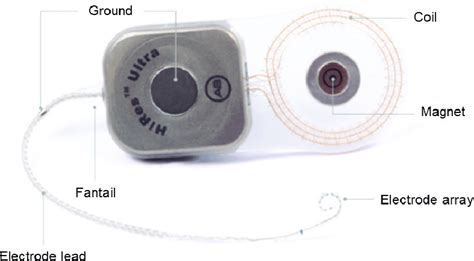 Ground Electrode Cochlear Implant