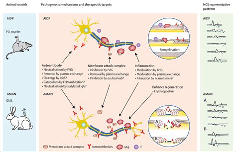 guillain barre syndrome pathophysiology