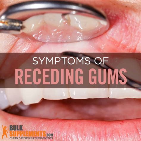 Gum Retreating From Tooth