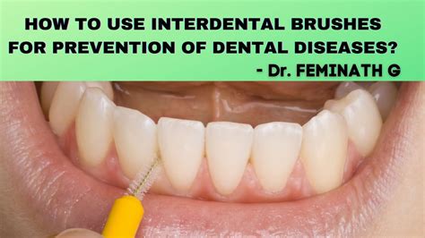 Gums Bleed When Using Interdental Brushes