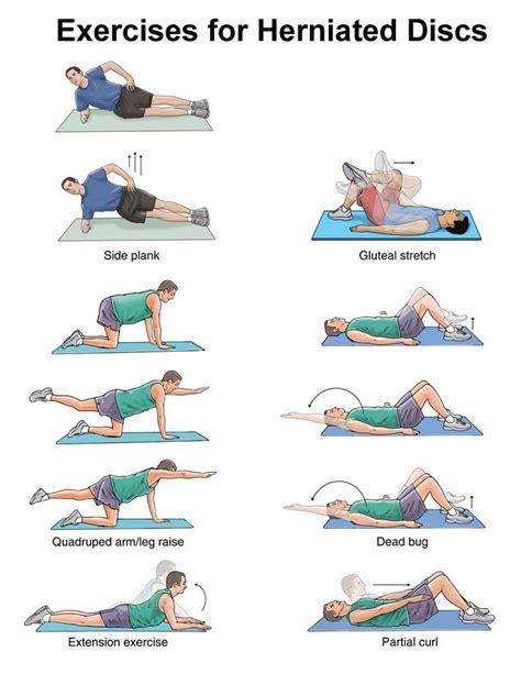 gym exercises with herniated disc