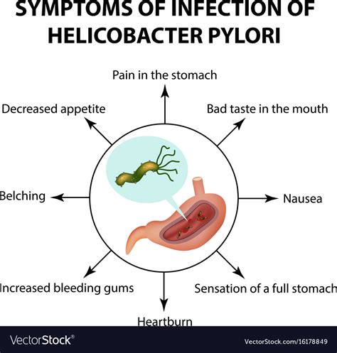 h pylori symptoms