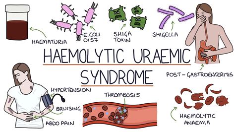haemolytic uraemic syndrome nice cks