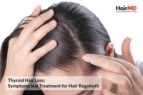 Synthroid Side Effects Hair Loss with regard to Property