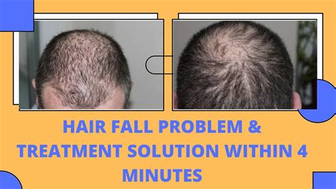 hair fall problem solution