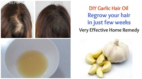 Garlic's Miraculous Hair Revival: Unlock Lush, Radiant Locks