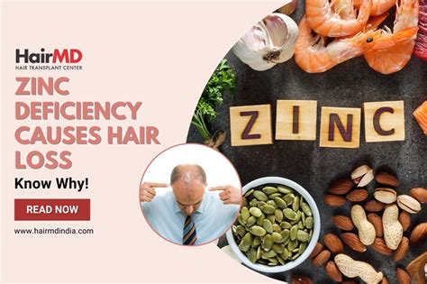 Zinc deficiency Signs and symptoms Nutrition, deficiency & diseases