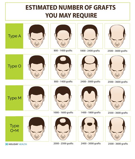 Hair Transplant Costs in Charlotte, Charleston and Columbia North