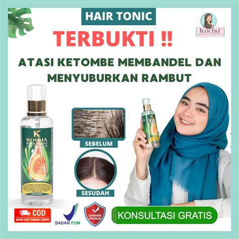 Atasi Rambut Rontok Parah dengan Hair Tonic Ampuh, Buktikan Sendiri!