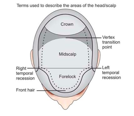 hairline crown and vertex