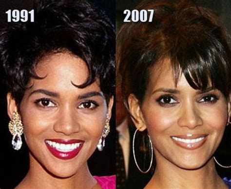 halle berry before surgery