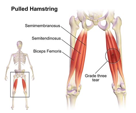 Hamstring Location On Body