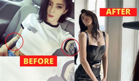 han so hee tattoo removal