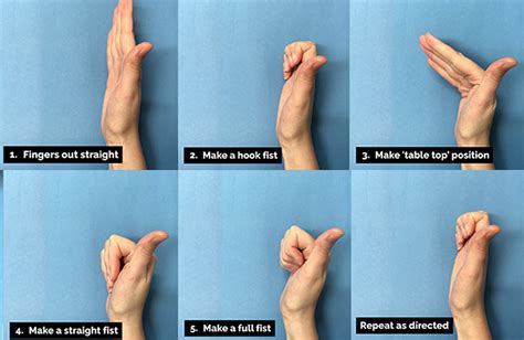 Hand Exercises To Help Trigger Finger