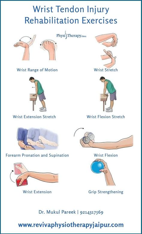 Hand Extensor Tendonitis Exercises