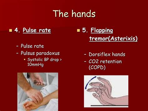 Hand Flapping Copd