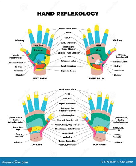 Hand Pain Location Chart