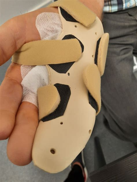 Hand Splints After Surgery
