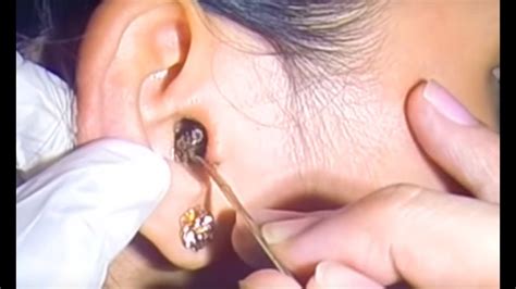 Earwax Removal at Home Remedies Cushions and Pillows