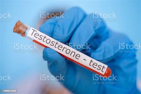 harga tes testosteron