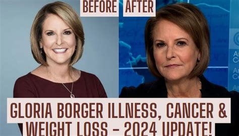Exploring The Health Journey Of Gloria Borger: Has She Been Sick?