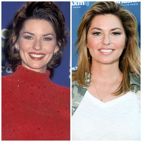 has shania twain had work done