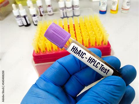 Hba1C Collection Bottle