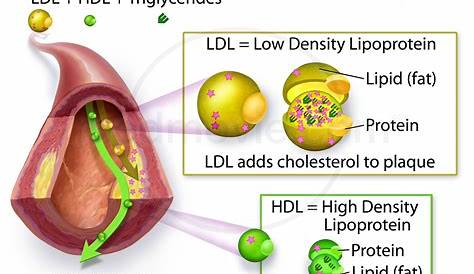 High Cholesterol on a Ketogenic Diet Lipid profile