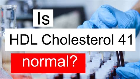 hdl colesterol 41 mg/dl