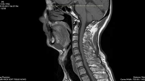 Head And Neck Radiology Cme