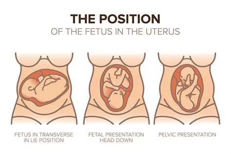 Head Down Position In 8Th Month