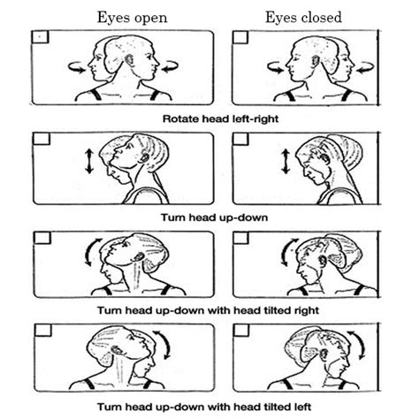 head exercises to help with vertigo